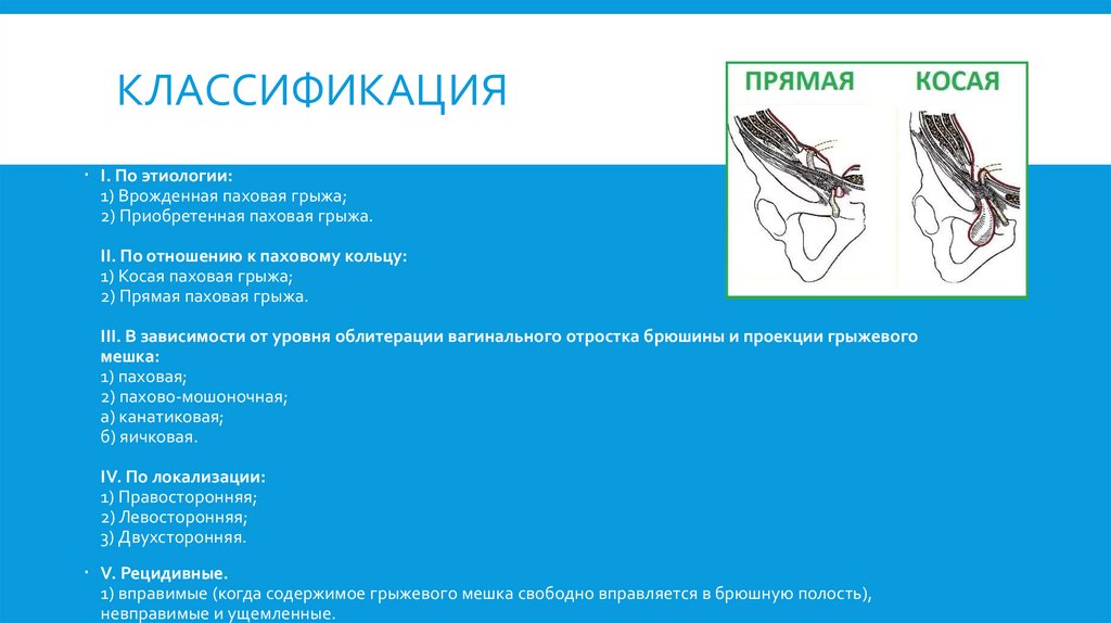 Классификация