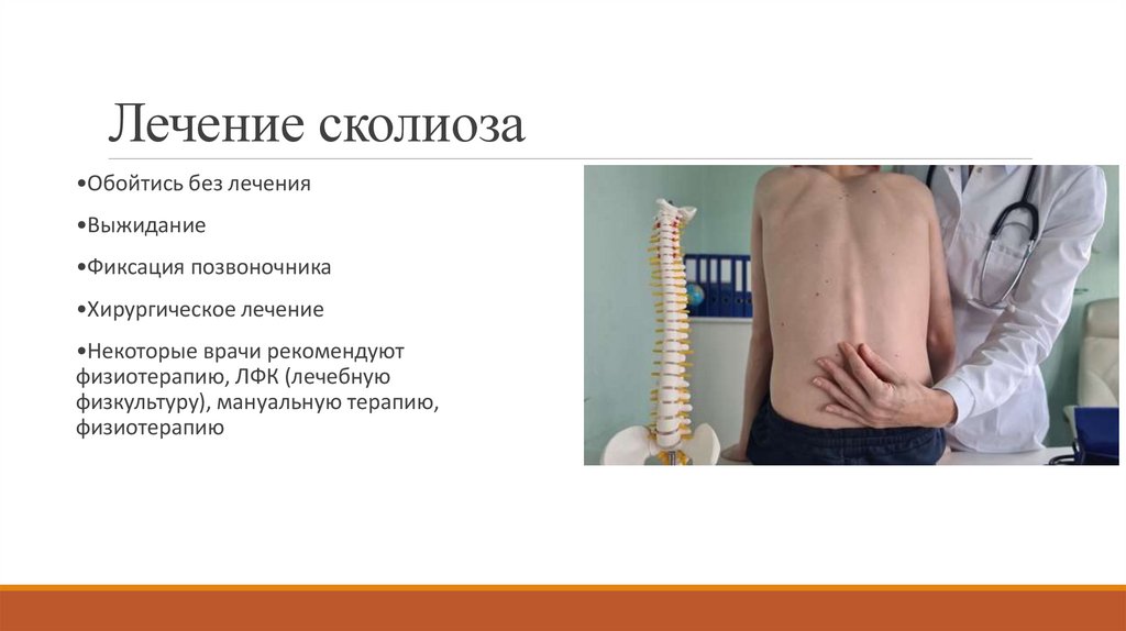 Лечение сколиоза