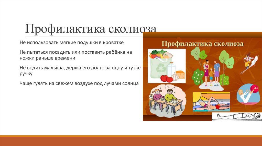 Профилактика сколиоза