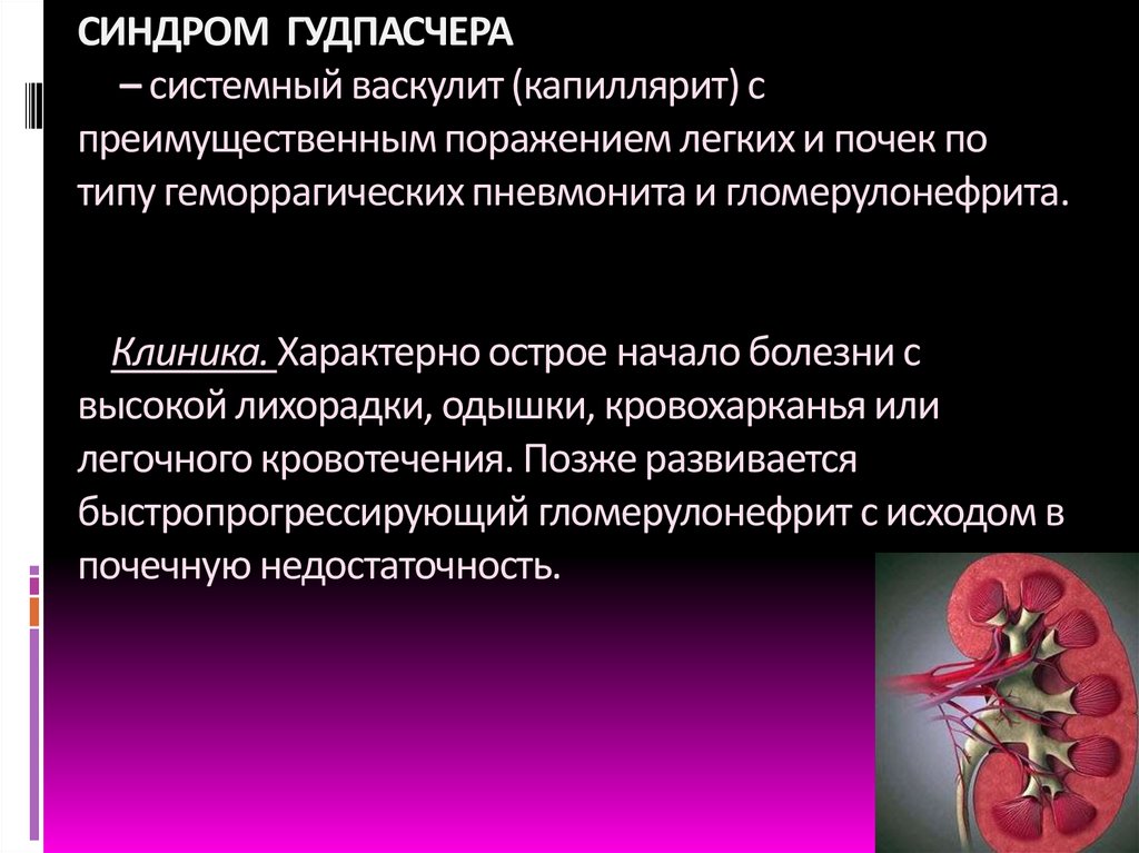 СИНДРОМ ГУДПАСЧЕРА – системный васкулит (капиллярит) с преимущественным поражением легких и почек по типу геморрагических