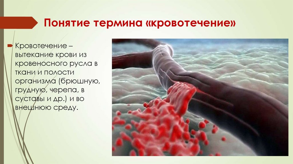 Понятие термина «кровотечение»