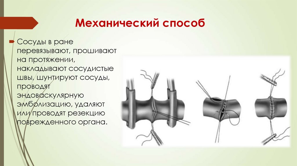Механический способ