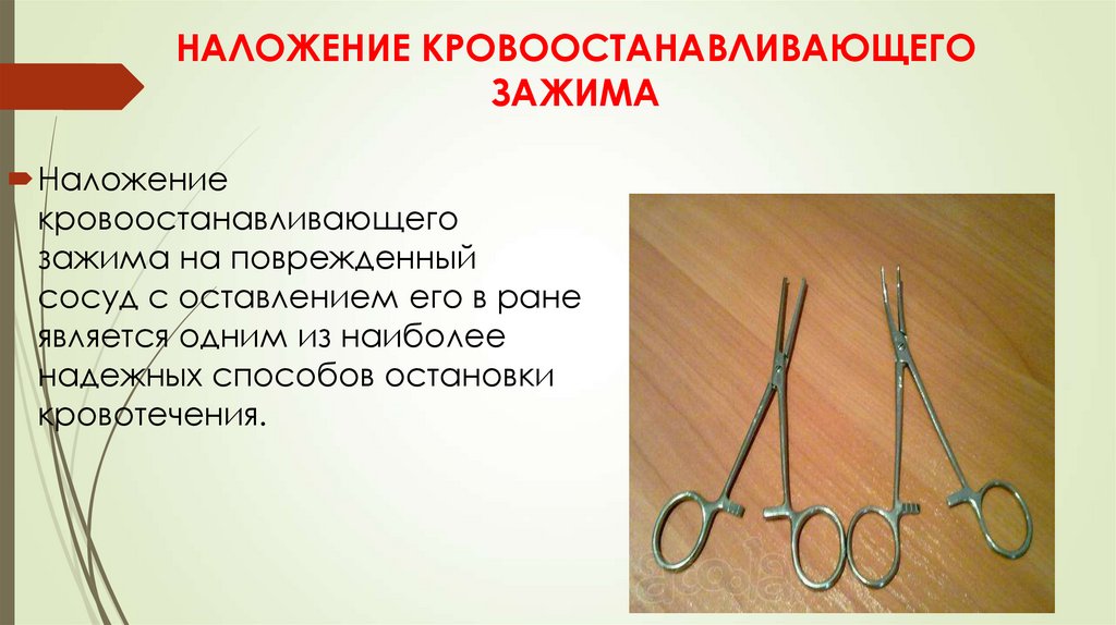 НАЛОЖЕНИЕ КРОВООСТАНАВЛИВАЮЩЕГО ЗАЖИМА