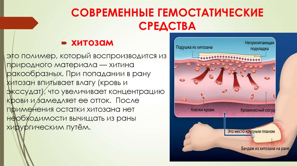 Современные гемостатические средства