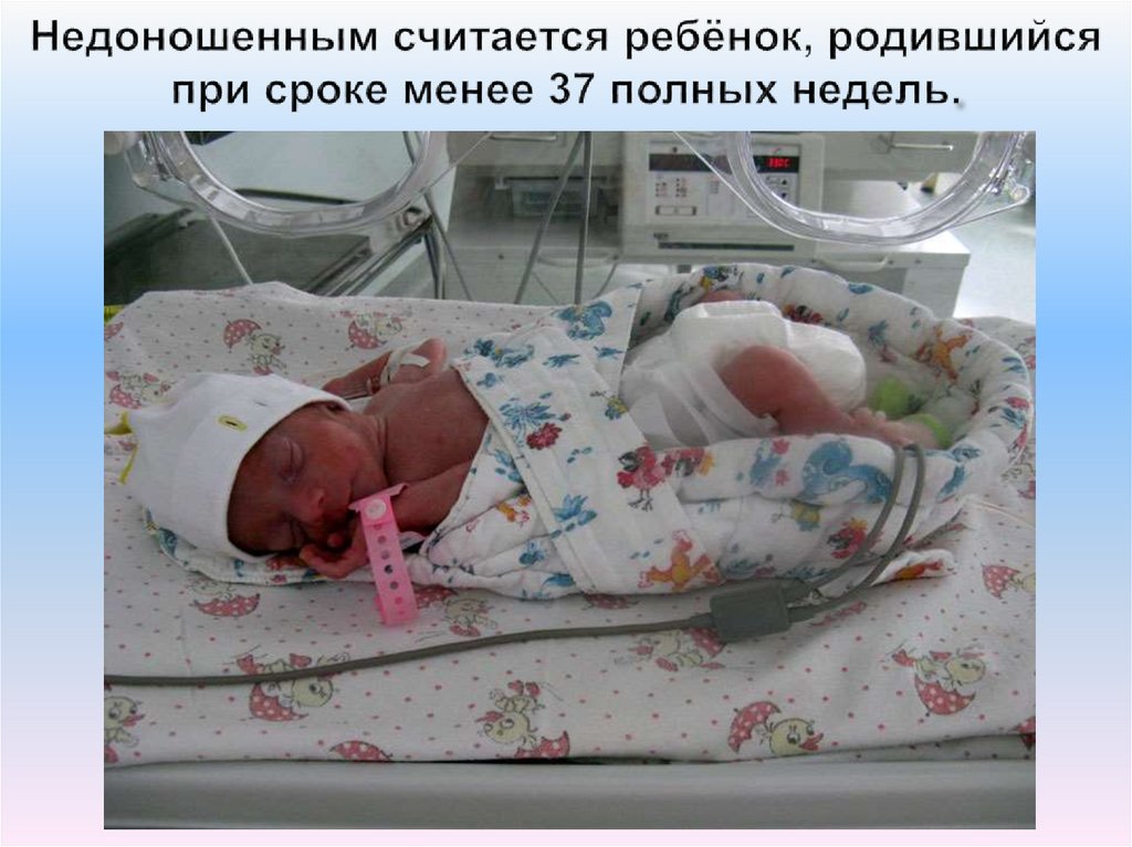 Недоношенным считается ребёнок, родившийся при сроке менее 37 полных недель.