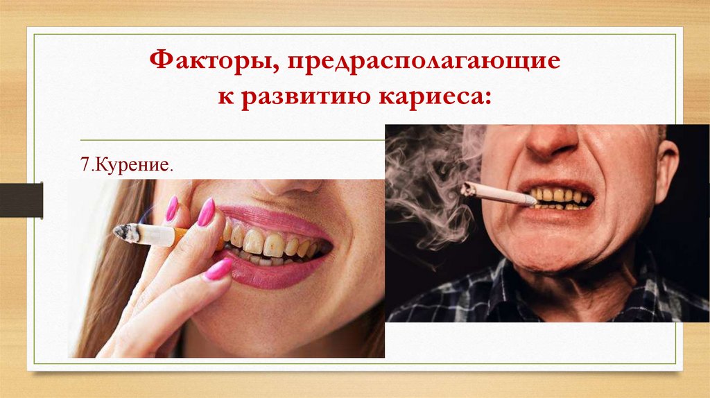 Факторы, предрасполагающие к развитию кариеса: