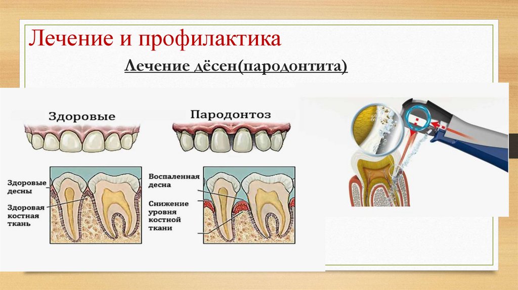Лечение и профилактика