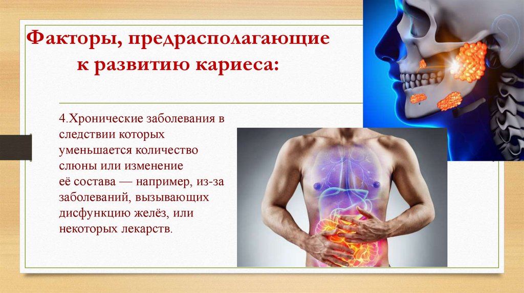 Факторы, предрасполагающие к развитию кариеса: