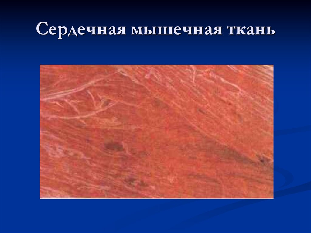 Сердечная мышечная ткань