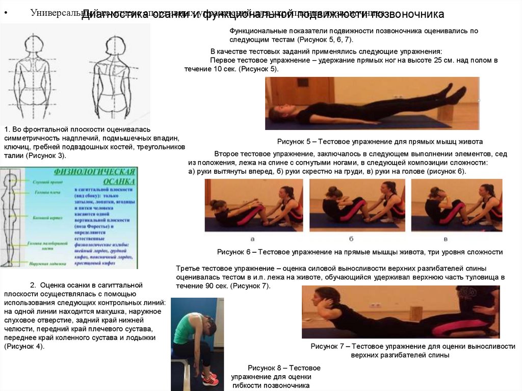 Диагностика осанки и функциональной подвижности позвоночника