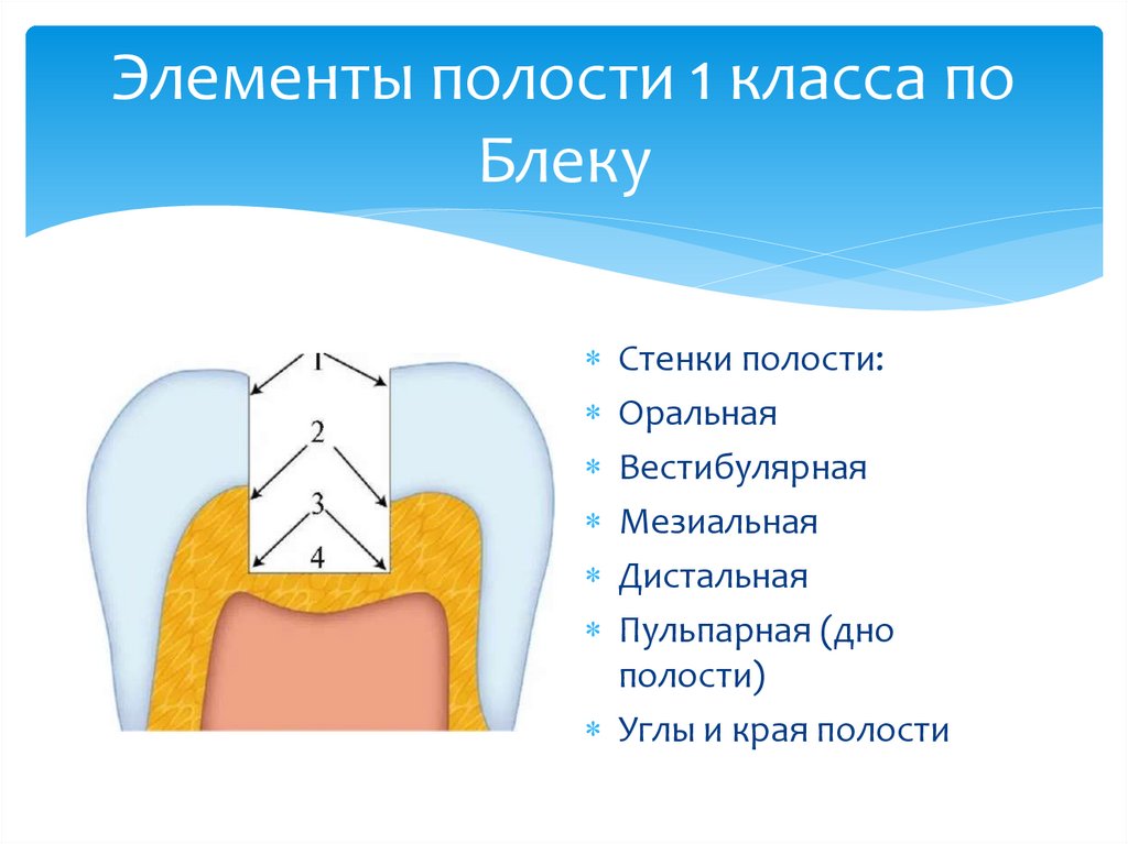 Элементы полости 1 класса по Блеку