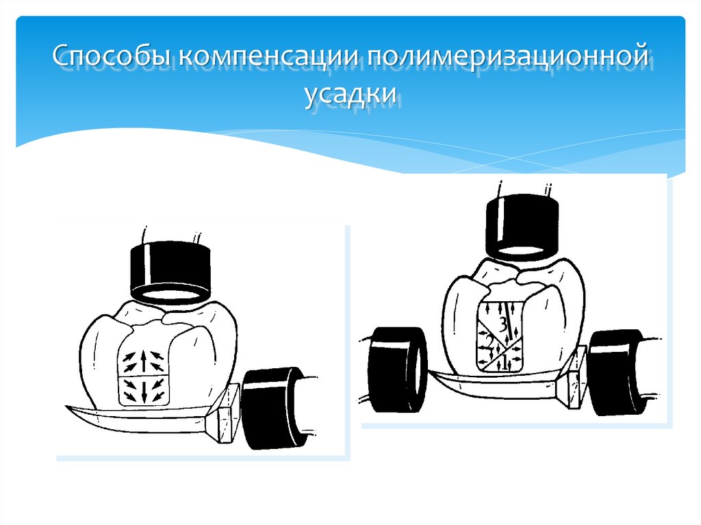 Способы компенсации полимеризационной усадки
