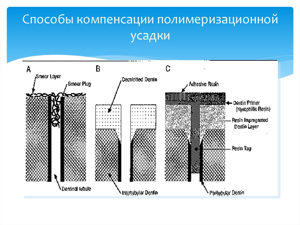 Способы компенсации полимеризационной усадки