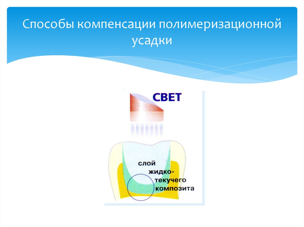 Способы компенсации полимеризационной усадки
