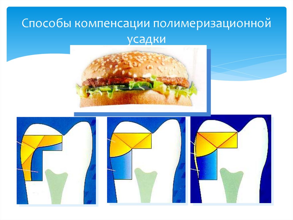 Способы компенсации полимеризационной усадки
