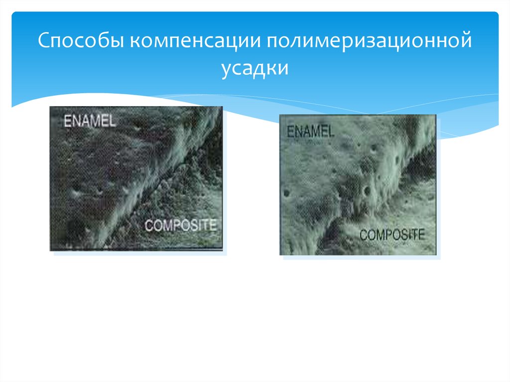 Способы компенсации полимеризационной усадки