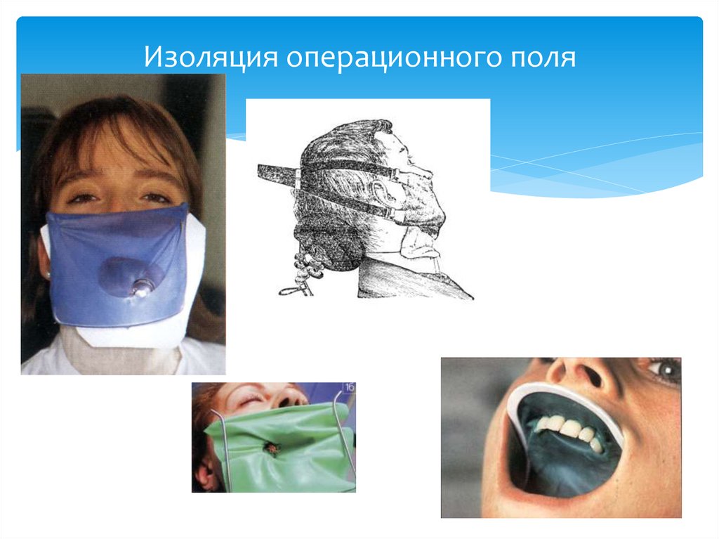 Изоляция операционного поля