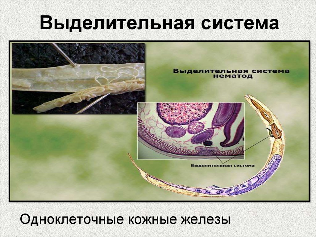 Выделительная система