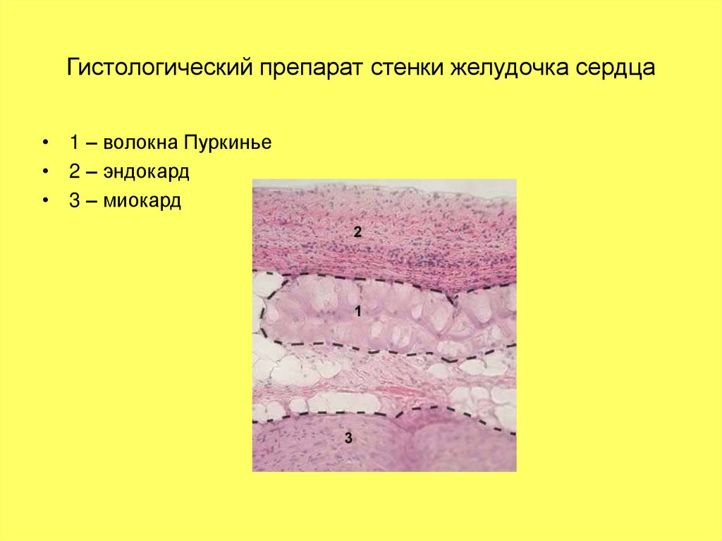 Гистологический препарат стенки желудочка сердца
