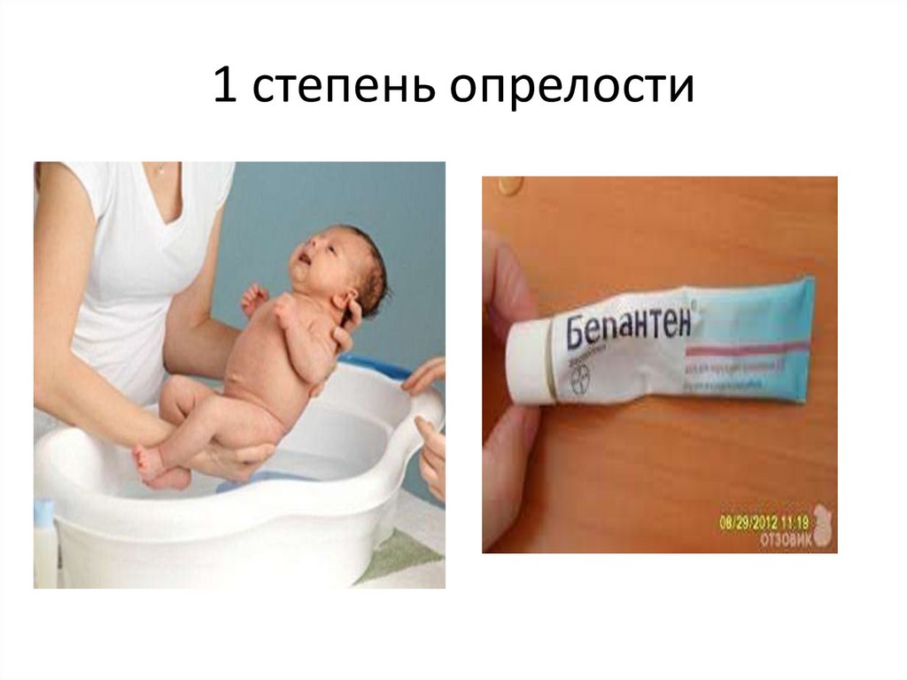 1 степень опрелости