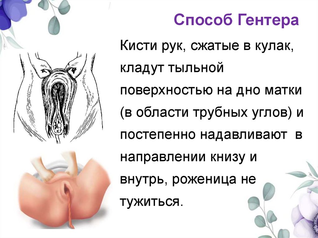 Способ Гентера