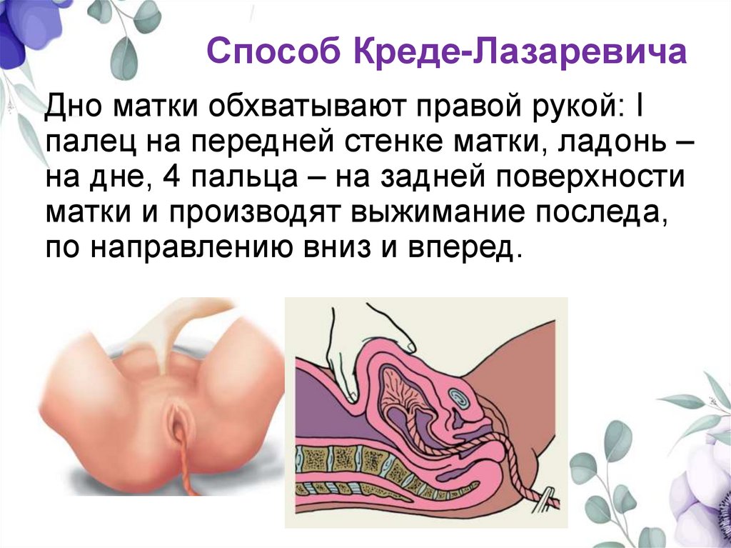 Способ Креде-Лазаревича