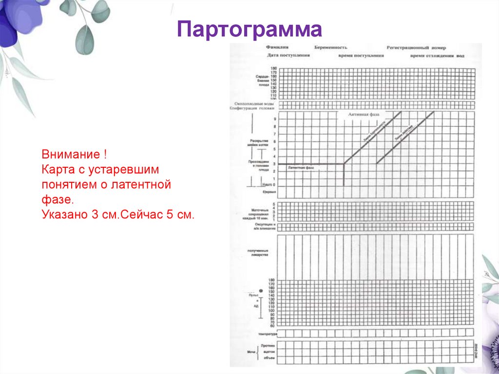 Партограмма