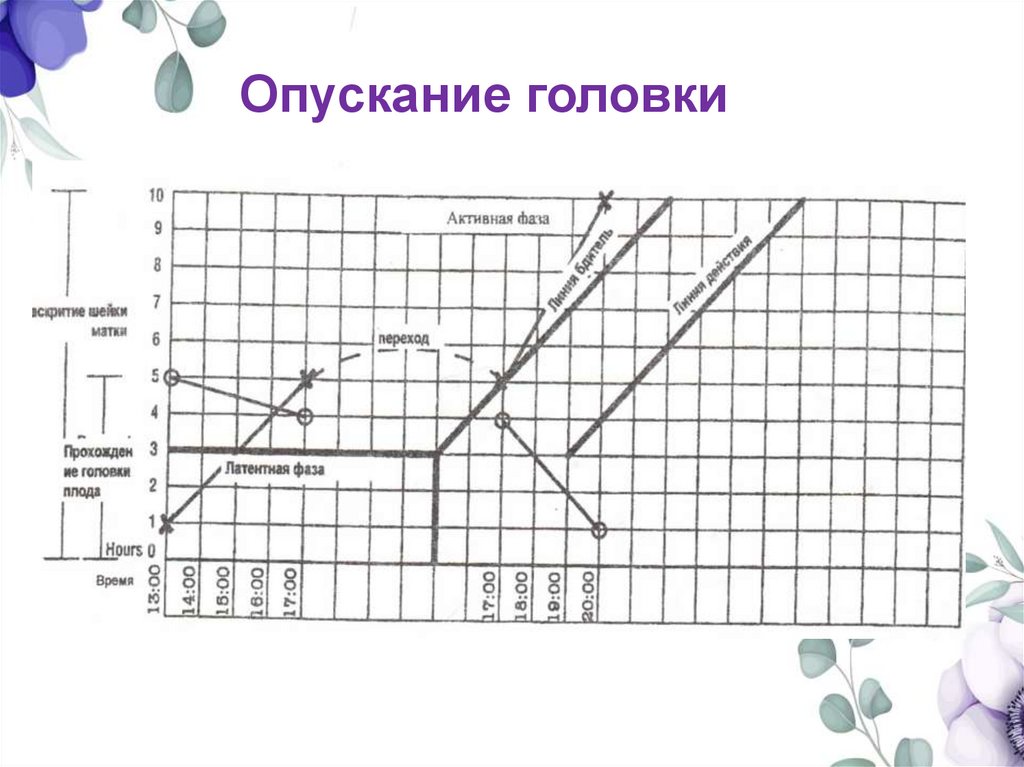 Опускание головки