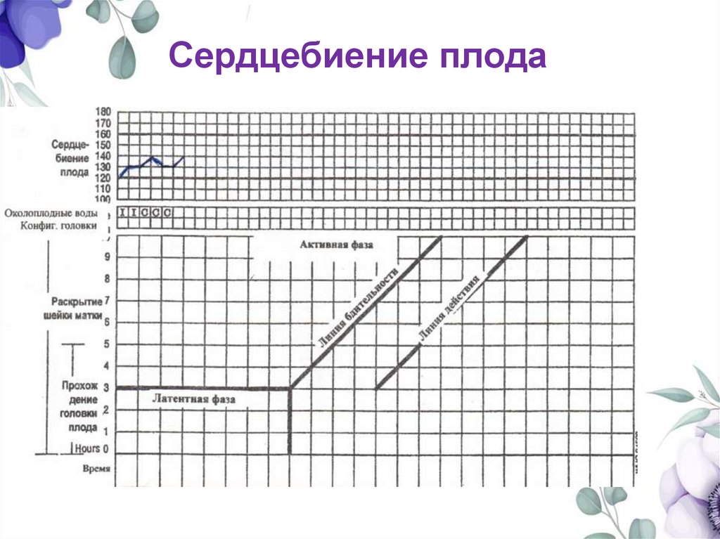 Сердцебиение плода