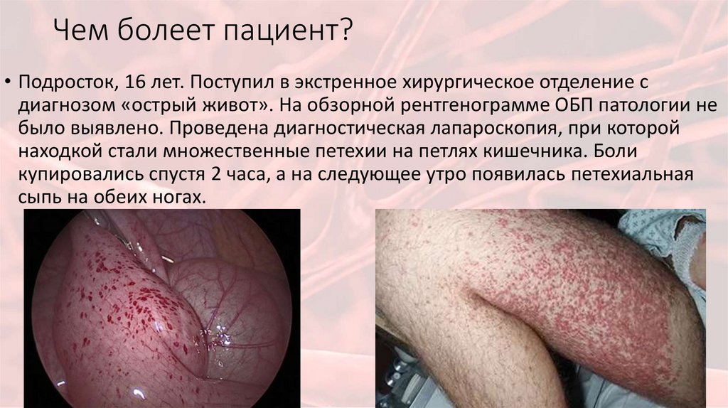 Чем болеет пациент?