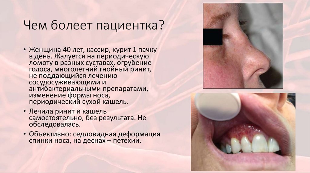 Чем болеет пациентка?