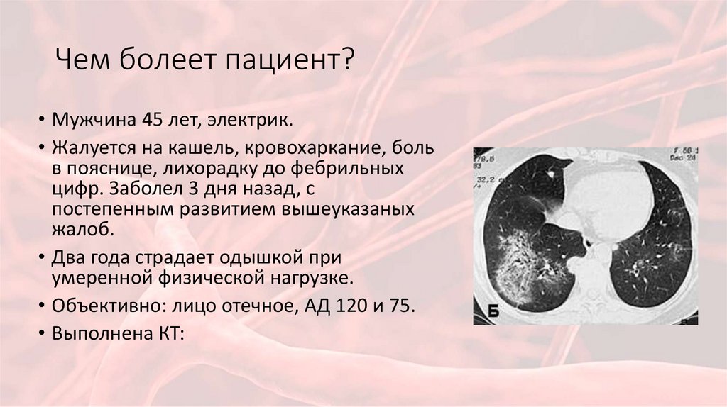 Чем болеет пациент?