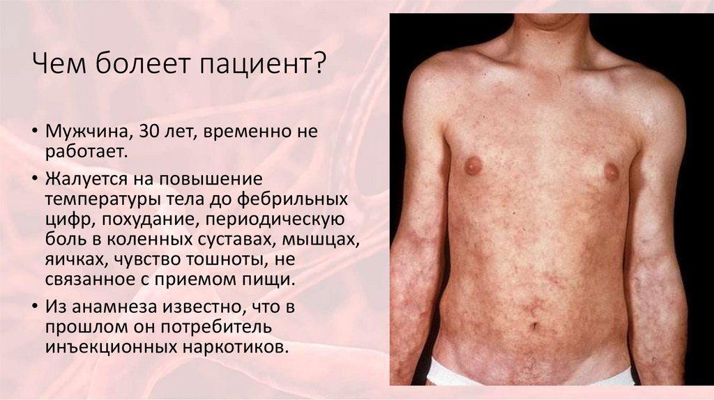 Чем болеет пациент?