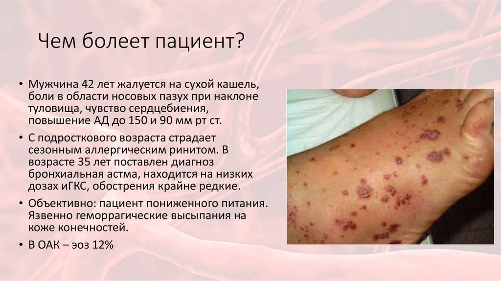 Чем болеет пациент?