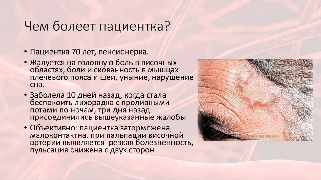 Чем болеет пациентка?