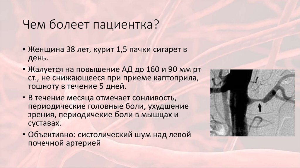 Чем болеет пациентка?