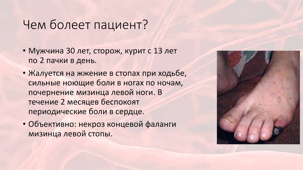 Чем болеет пациент?