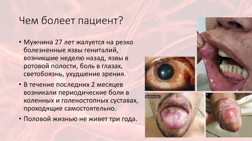 Чем болеет пациент?
