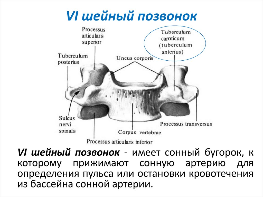 VI шейный позвонок