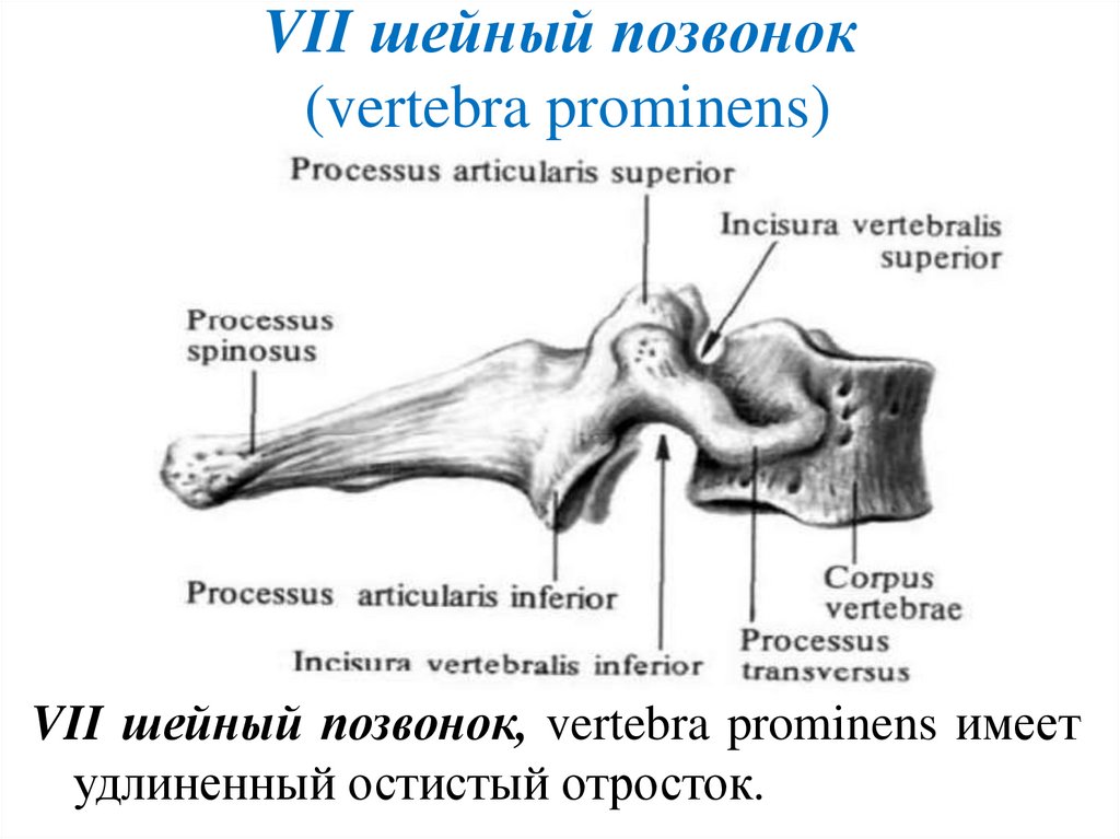 VII шейный позвонок (vertebra prominens)