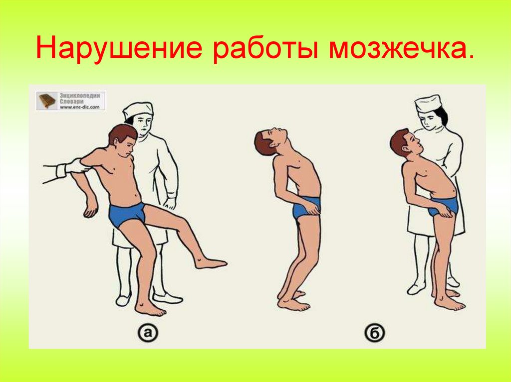 Нарушение работы мозжечка.