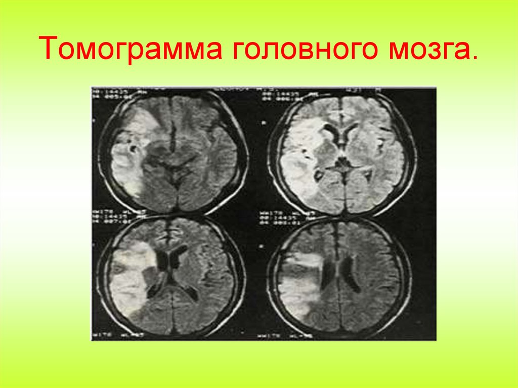 Компьютерные томографы.
