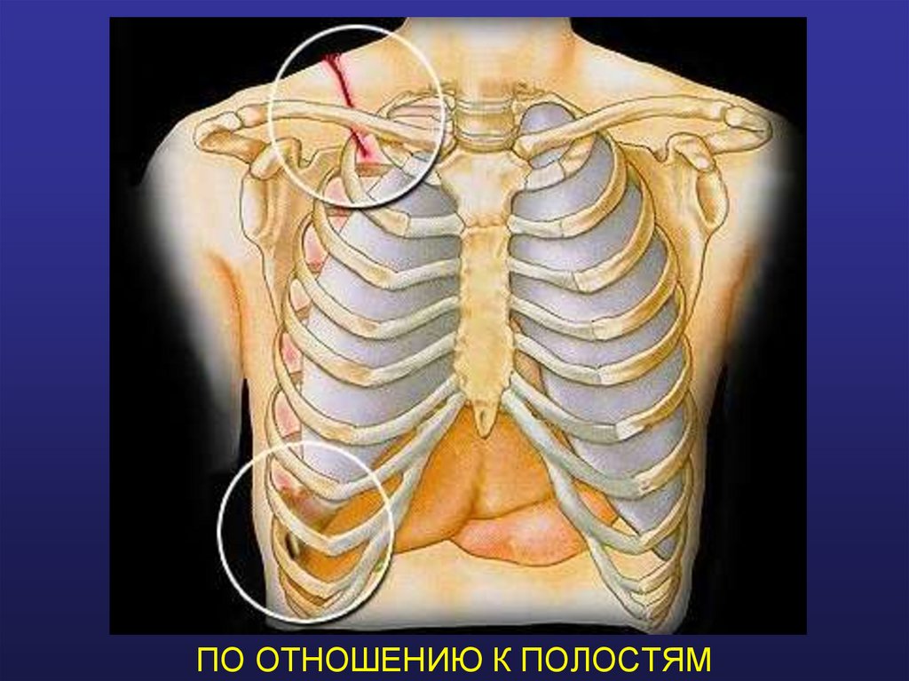 ПО ОТНОШЕНИЮ К ПОЛОСТЯМ