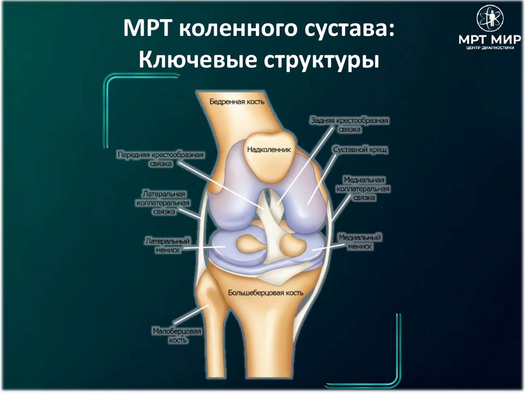 МРТ коленного сустава: Ключевые структуры