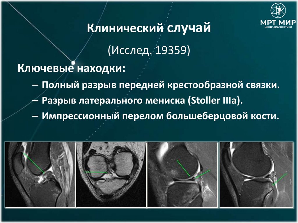 Клинический случай
