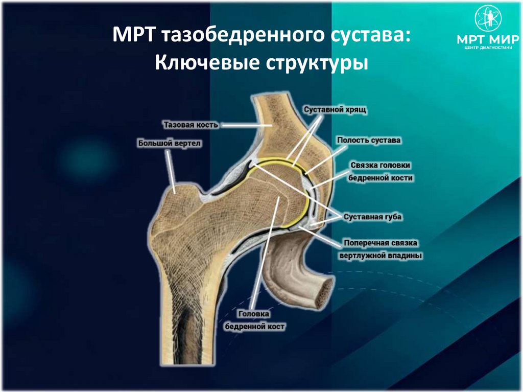 МРТ тазобедренного сустава: Ключевые структуры