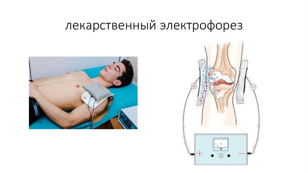 лекарственный электрофорез