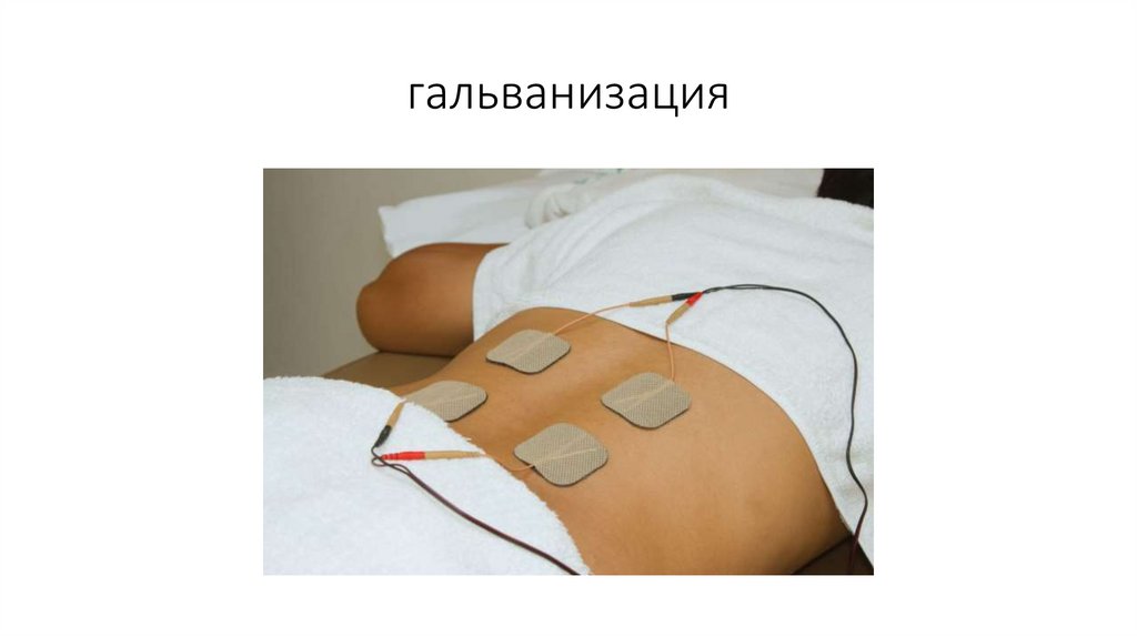 гальванизация