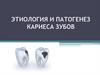 Этиология и патогенез кариеса зубов