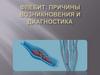 Флебит: Причины возникновения и диагностика